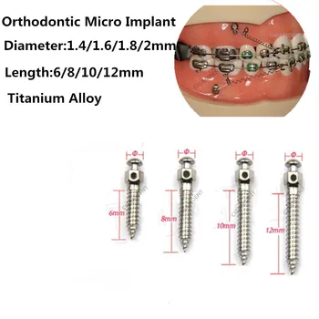10шт зубных мини-имплантатов с микровинтами, отвертка для имплантатов из титанового сплава, гаечный ключ для самосверления 1.4/1.6/1.8/2.0 мм