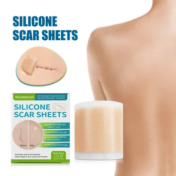 4 х 150 см Силиконовые листы для шрамов, пластырь для восстановления кожи, удаление самоклеящейся ленты для лечения растяжек, пластырь для лечения ожогов, шрамов от угревой сыпи, Уход за кожей