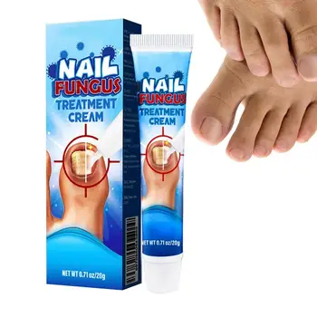Восстанавливающий крем для ног для ног 0,71 унции Эффективный Крем для обновления ногтей на ногах Натуральный Бальзам повышенной прочности для обесцвеченных ногтей